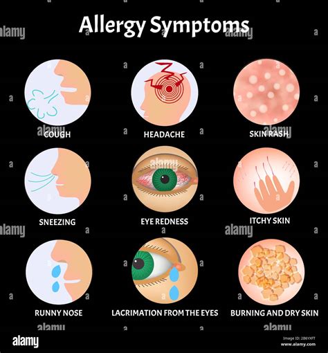 Itchy Eyes Allergy Symptoms Without