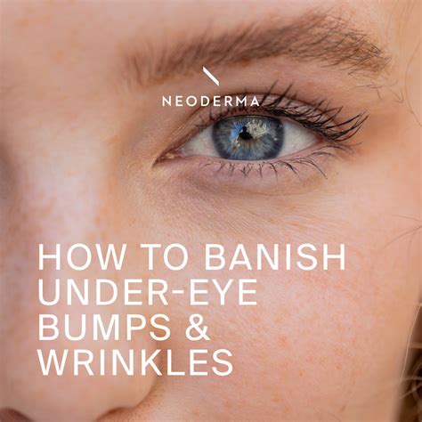 How to Banish Under-Eye Bumps and Wrinkles | NEODERMA