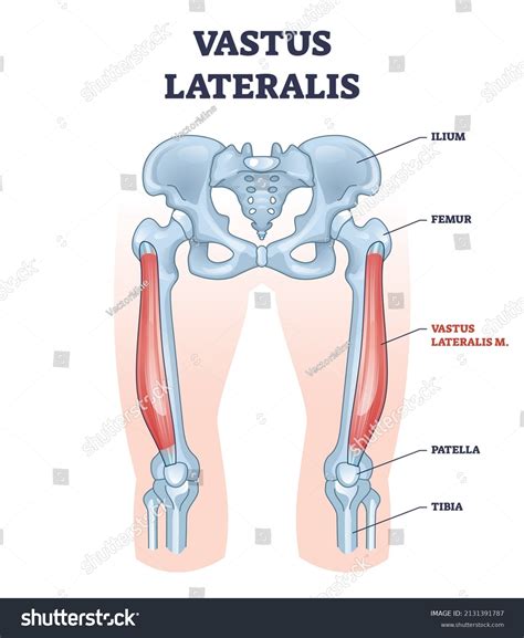 Vastus Lateralis Esnemesi