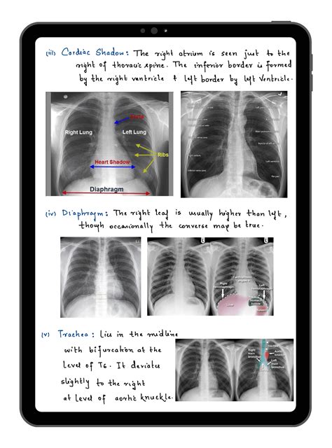 MedNotes - For Medical Students