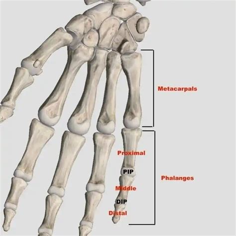 Image result for Finger Dislocation Treatment