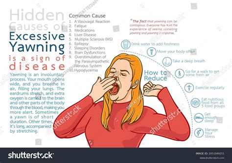 Infographic Illustration Hidden Causes Excessive Yawning Stock Vector (Royalty Free) 2051049251 ...