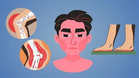 A Comprehensive Guide to EDS Pain Management