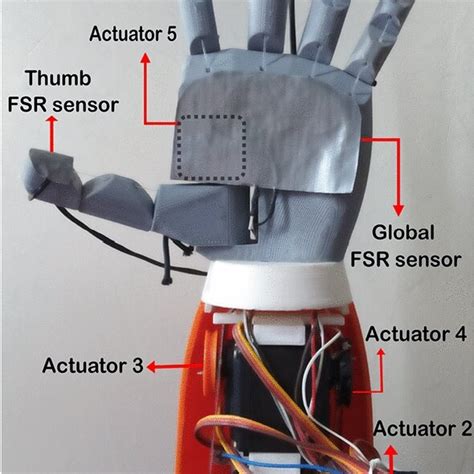 How to Use a Hand Prosthesis 的图像结果