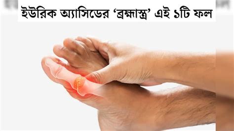 Uric Acid: ইউরিক অ‍্যাসিডের ‘ব্রহ্মাস্ত্র’ এই ফল! রোজ ১ টা করে খেলেই ...