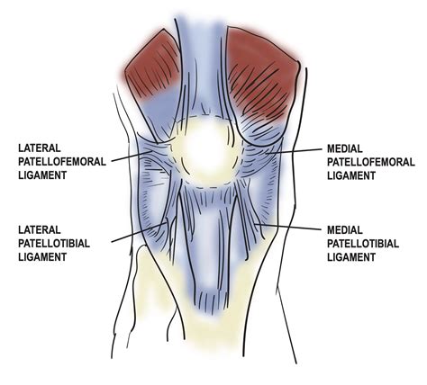 Anatomy, Bony Pelvis and Lower Limb: Medial Patellofemoral Ligament | Treatment & Management ...