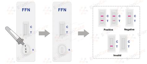Image result for Fetal Fibronectin Collection Kit