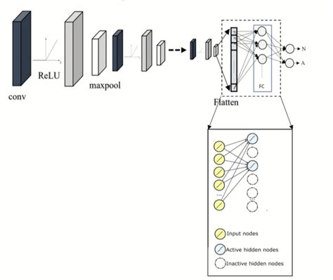 Image result for Dropout Regularization