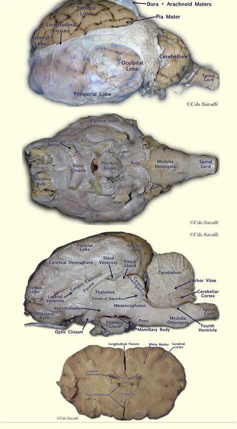Arachnoid Mater Sheep Brain