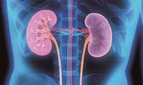 Uncontrolled hypertension silently damaging kidney health in India: Experts