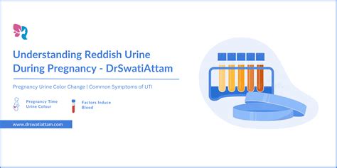 Ultimate Guide to Understanding Reddish Urine During Pregnancy