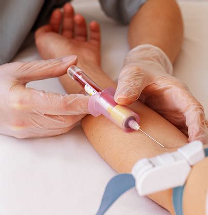 Lab Data Collection 的图像结果