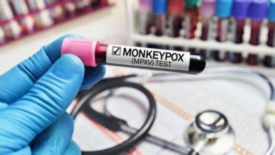 India'S 1st Mpox RT-PCR Kit: India's First Mpox RT-PCR Kit Developed by ...