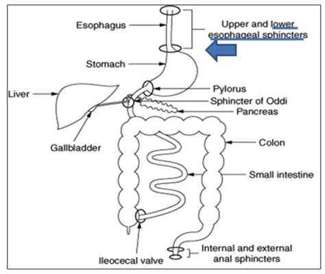 Image result for Colon Polyps Types