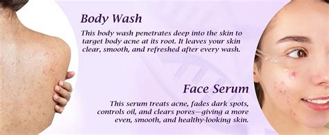Dermistry 1% Salicylic Acid Back Acne Open Pores Excess Oil Removal ...