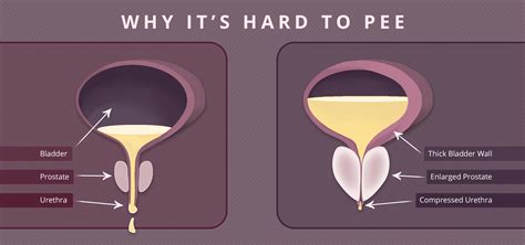 Bladder Holds Urine at Frank Keith blog