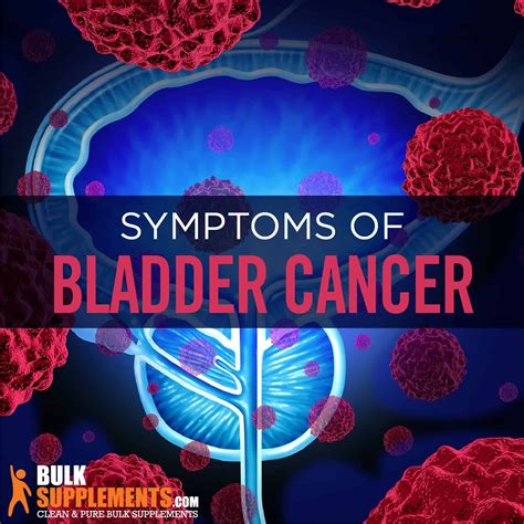 Bladder Cancer 的图像结果