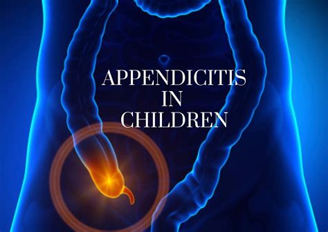 Clinical Manifestations of Appendicitis in Children – The Operating ...