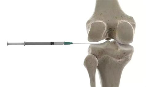 10 mg of triamcinolone acetonide non-inferior to 40 mg triamcinolone ...