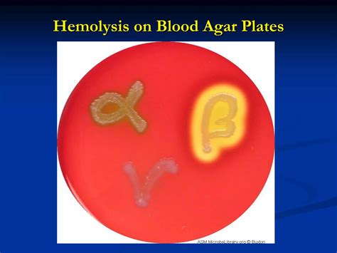 4 blood agar and hemolysis and mac-conkey.ppt