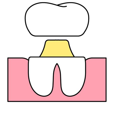 Image result for Tooth Mobility Classification Chart