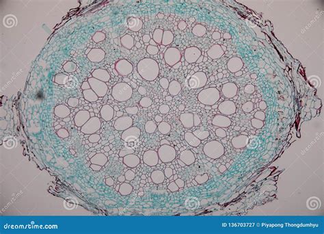 Dicot Root Cross Section