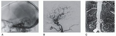 Image result for Contrast Fluoroscopy