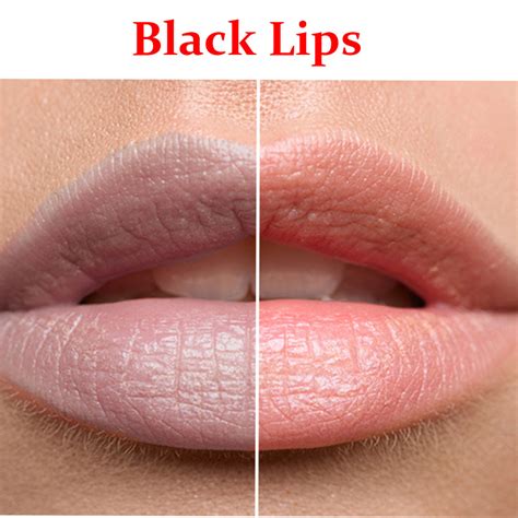 Black Lips- Product Box – Sharma Pharmacy