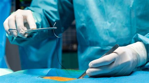 Incision & Surgical Wound Care: Why Stitches Get Itchy And How To ...