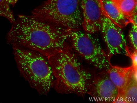 citrate synthase antibody (67784-1-Ig) | Proteintech