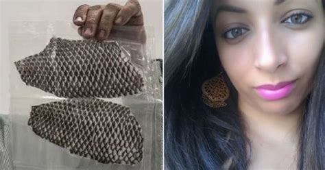 Brazilian Woman Born Without A Vagina Has A New One Made Using Tilapia ...