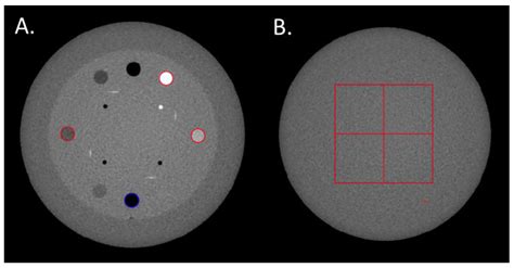 Task-Based Image Quality Assessment Comparing Classical and Iterative ...