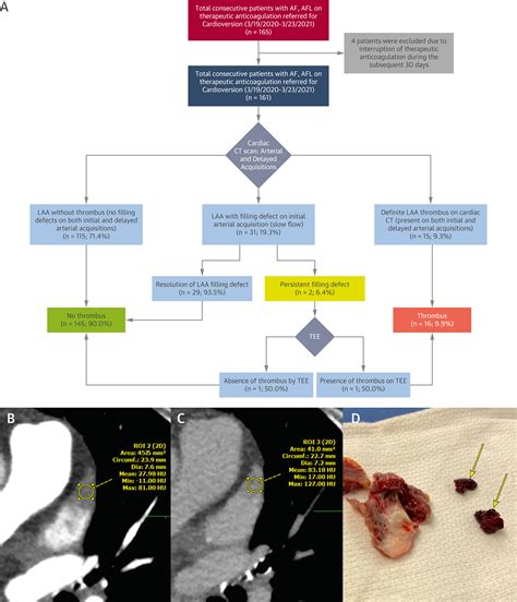CT-Guided Direct Current Cardioversion for Atrial Arrhythmias During ...