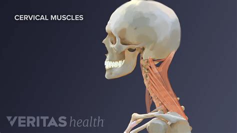 What Causes Neck Spasms?