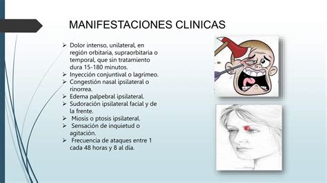 CEFALEA en racimos concepto, causas pptx | PPTX