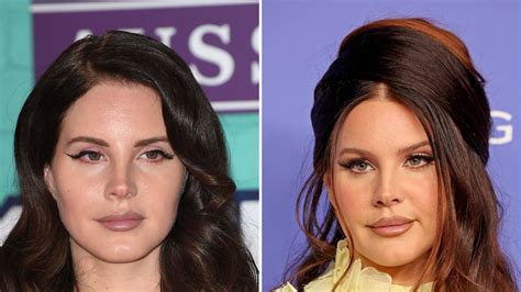 Did Lana Del Rey Get Plastic Surgery? Then and Now Photos | Life & Style