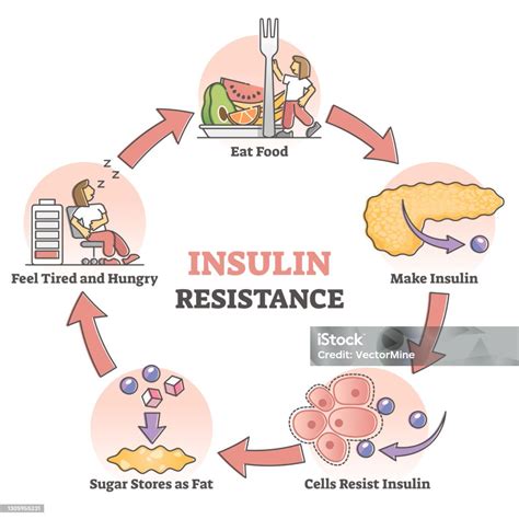 Insulin Resistance Pathological Health Condition Educational Outline Diagram Stock Illustration ...