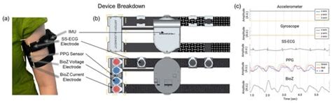 Biosensors | Special Issue : Wearable Biosensors for Health Monitoring
