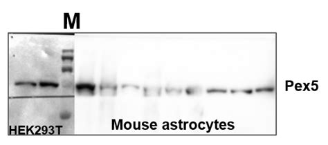 PEX5 antibody (12545-1-AP) | Proteintech