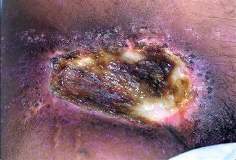Image result for Alien Torch