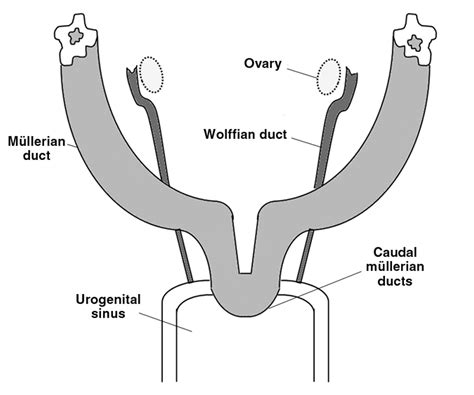 Mullerian Duct Anatomy