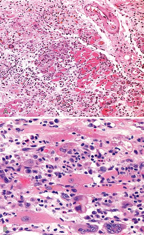 Heart, Pericardium, and Blood Vessels - Clinical Tree
