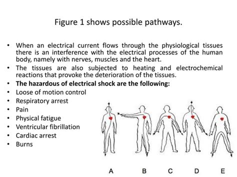 Electricity Shock 的图像结果