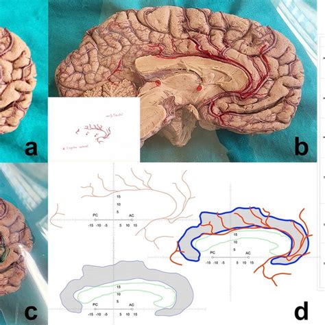 Cingulate Gyrus Function 的图像结果