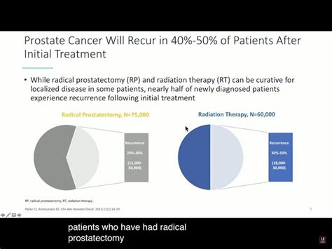 Prostate Cancer Recurrence 的图像结果