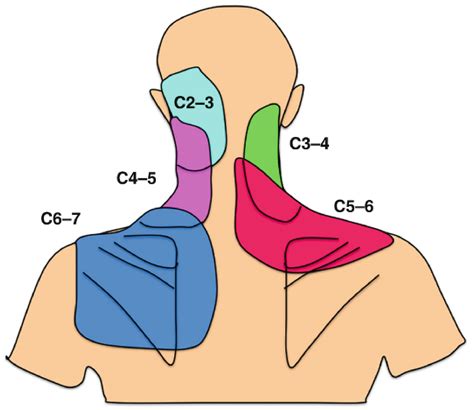 Oral | Free Full-Text | Self-Reported Mandibular Impairment and ...