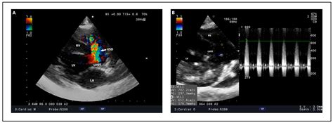 A Comprehensive Review of Canine and Feline Ventricular Septal Defects ...