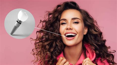 Image result for Different Types of Teeth Implants