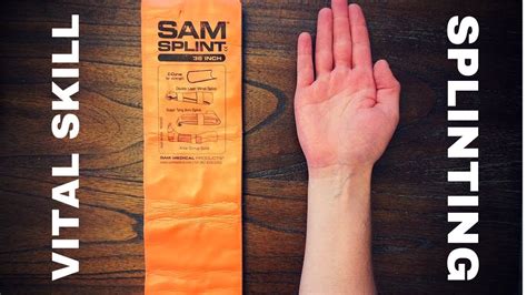 Image result for How to Use Splint