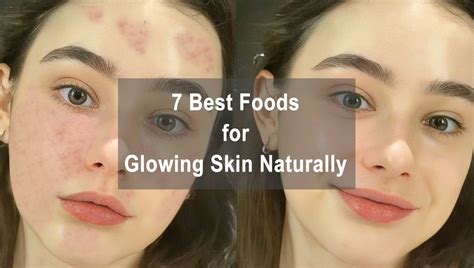 7 Best Foods for Glowing Skin Naturally | Boost Your Skin Healthy – D ...